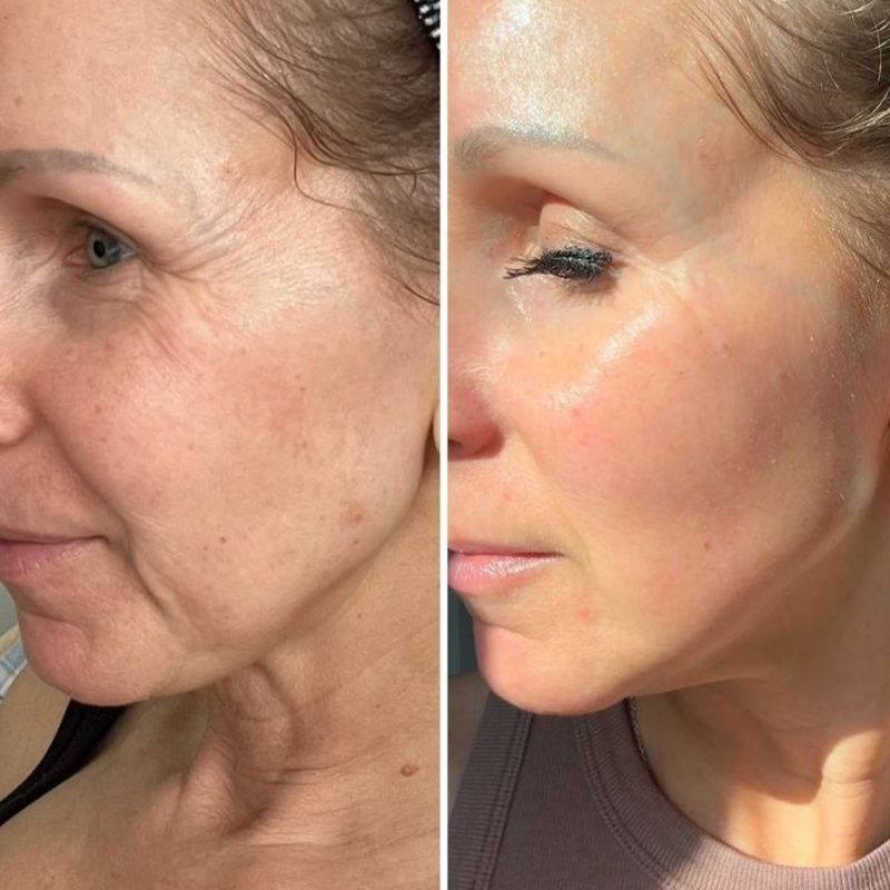 Réduit les inflammations